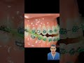 No todos los pacientes usan elásticos , pero cuando se indican son indispensables.