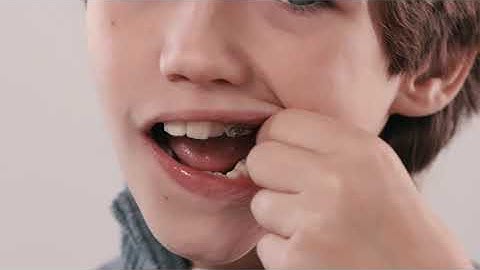 How to Connect Your Rubber Bands to Carriere® Motion 3D