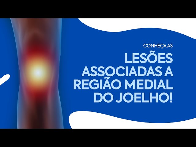 Conheça as lesões associadas a região medial do joelho!