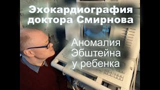 38. Аномалия Эбштейна У Ребенка (Ebstein's Anomaly)