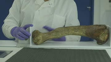 FORENSIC ANTHROPOLOGY MSc