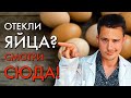 Отек яичка и мошонки | 7 главных причин | Орхоэпидидимит, варикоцеле, водянка, паховая грыжа и...