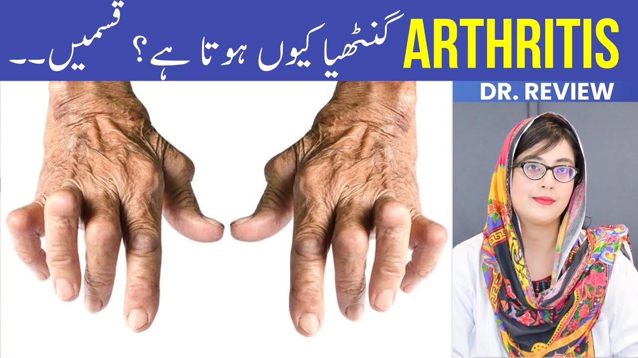 Arthritis Types, Causes & Symptoms Ghanthiya Kiya Hai aur Q Hota hai