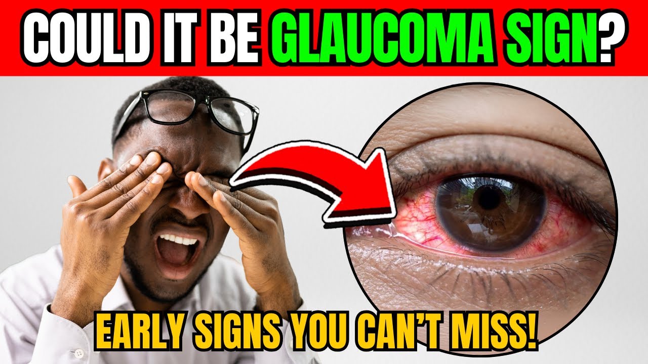 The Early SIGNS of GLAUCOMA 90% of People IGNORE! - YouTube