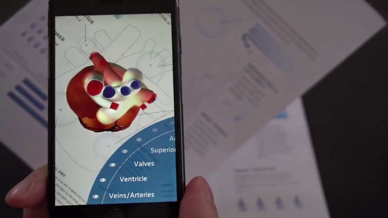 Asvide: 4D Anatomy Augmented reality app of the heart and human body