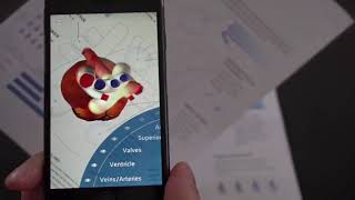 Asvide: 4D Anatomy Augmented reality app of the heart and human body screenshot 3