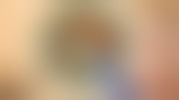 Direct Chop in Hard Leathery Cataract