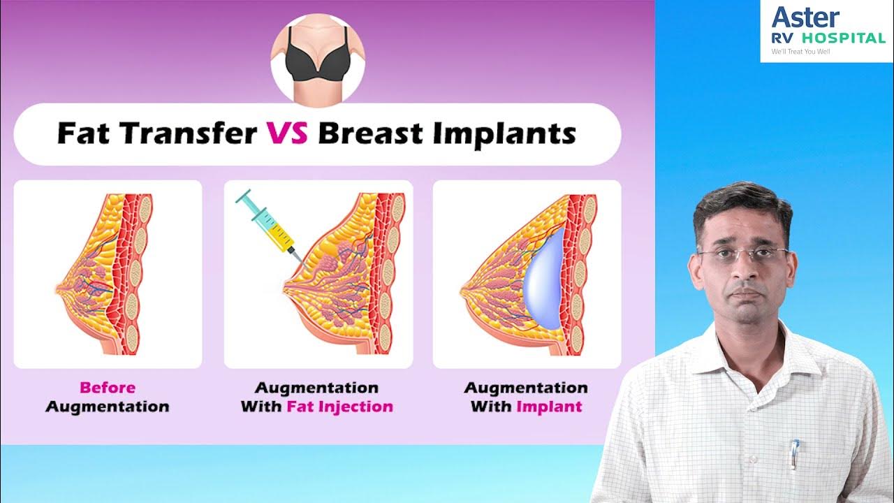 Breast Augmentation Surgery  Breast Implant Surgery Mangalore