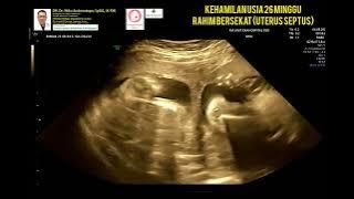 Uterus septus kehamilan 26 minggu