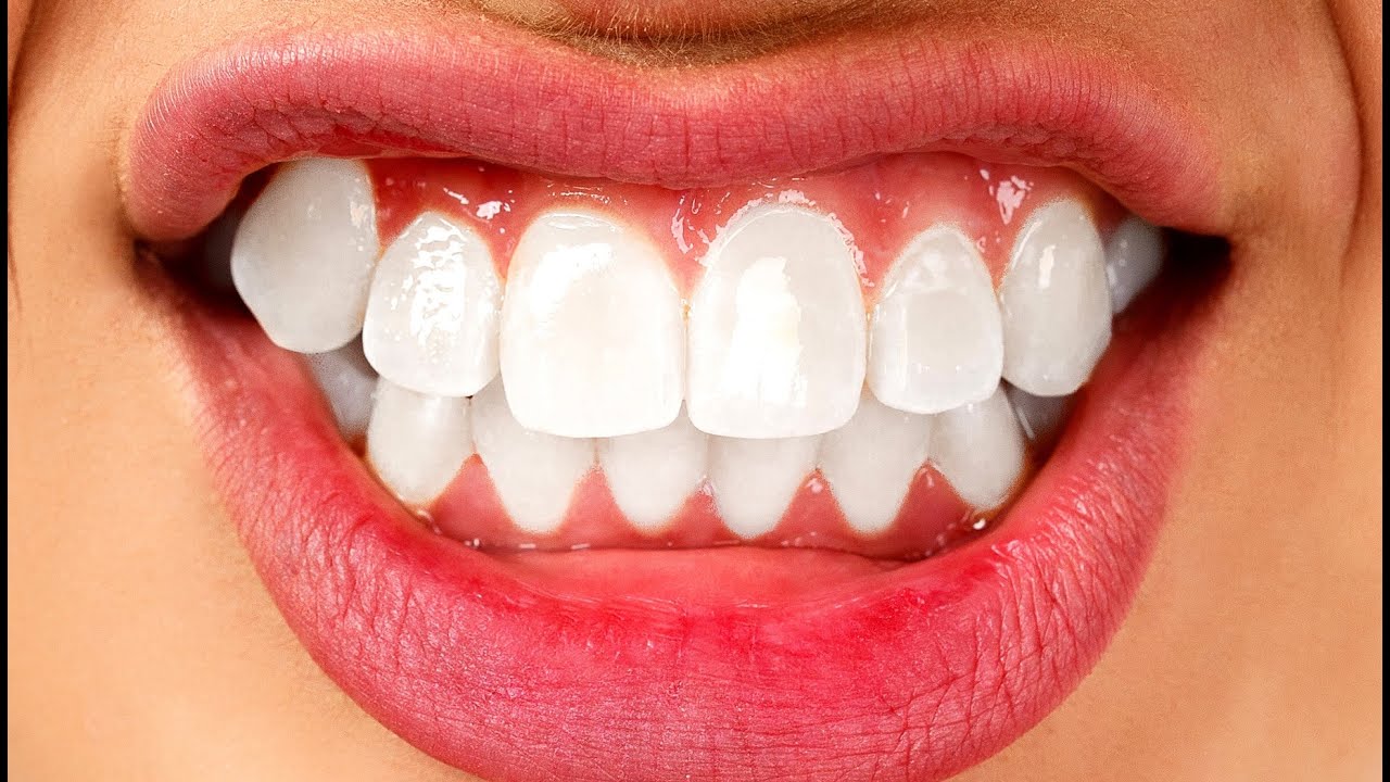 Home Remedies For Toothache Fast Tooth Pain Relief YouTube