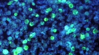 Practical Importance of Human Evolution - Superorganisms - Your Viral Self