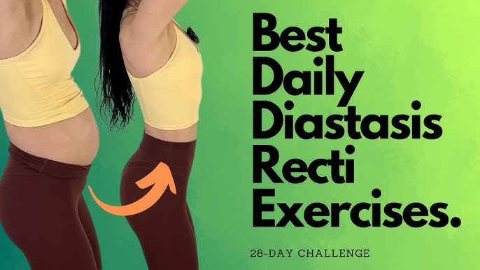 EXERCISE & DIASTASIS: Diastasis Exercises Do's & Don'ts (Exercise Modi –  diastasisrehab