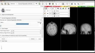 Slicer Registration