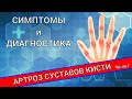 АРТРОЗ СУСТАВОВ КИСТИ (Часть 1)