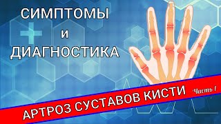 АРТРОЗ СУСТАВОВ КИСТИ (Часть 1)