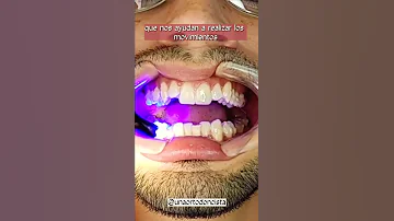 ¿Tengo que cepillarme los dientes antes de ponerme Invisalign?