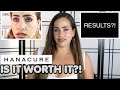 Hanacure: Is It Worth It?! [BEST KOREAN FACE MASK 2020]