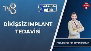 Dikişsiz Implant Tedavisi Nedir? Prof Dr Mehmet Oğuz Öztoprak 8De Sağlık