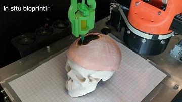 in situ bioprinting workflow