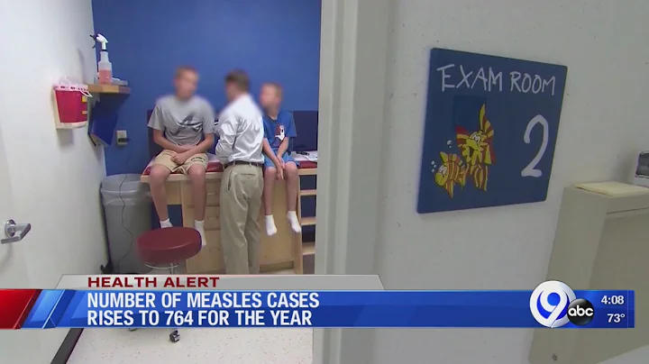 Measles cases on the rise