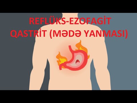 Video: Refluks Esofagit - Behandling Av Reflux Esofagit Med Folkmedicin Och Metoder