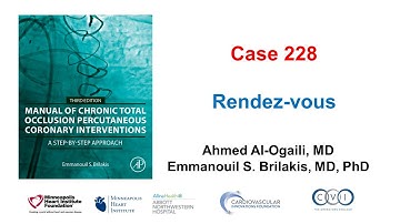 Case 228: Manual of CTO PCI - "Rendez-vous"
