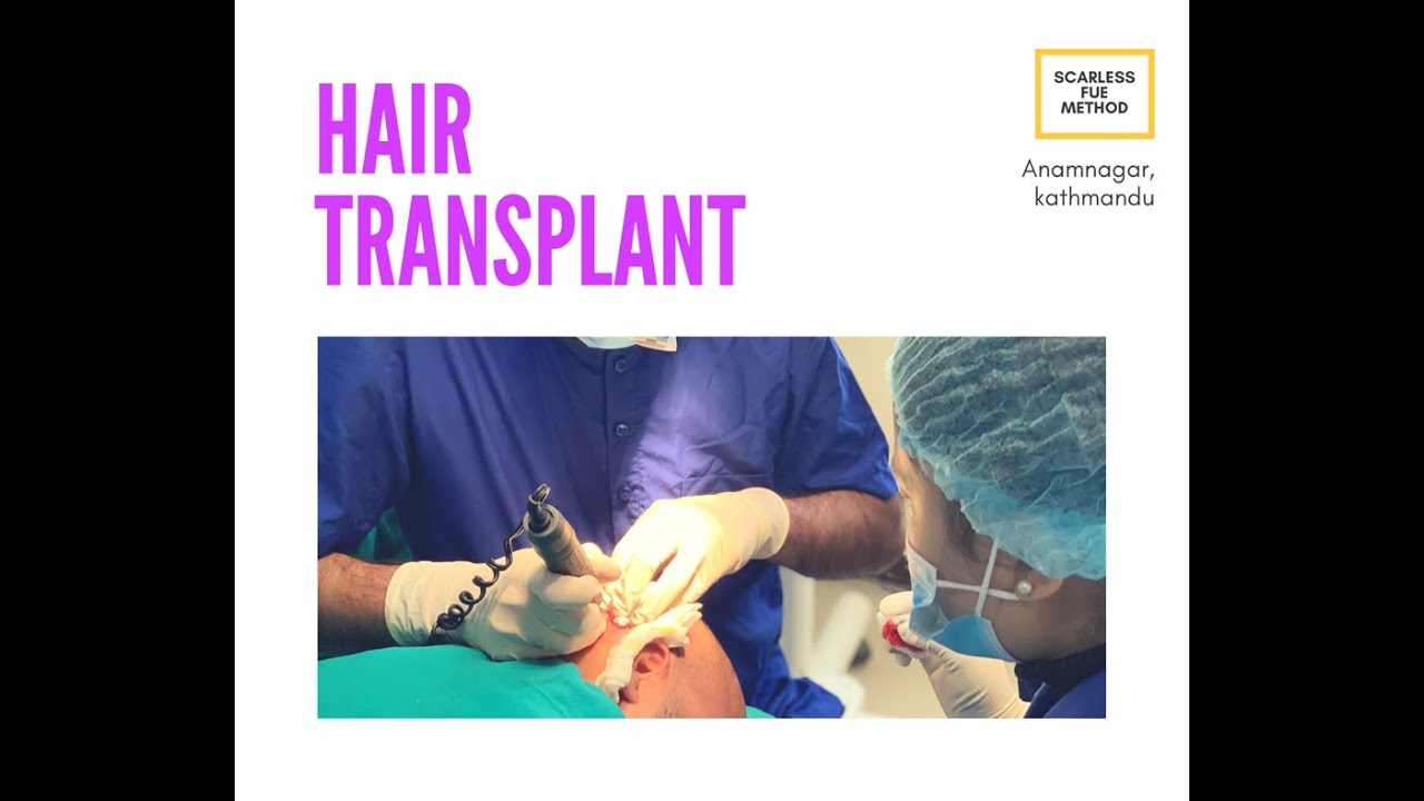 hair transplant in nepal YouTube