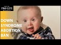 Pro-Life Senator to Introduce Down syndrome Abortion Ban