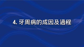 4. 牙周病的成因及過程