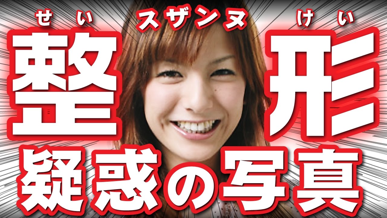 スザンヌ 整形