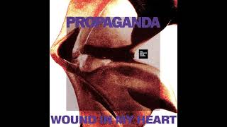 Propaganda - Wound in My Heart (LYRICS) FM HORIZONTE 94.3 CHANNEL screenshot 3