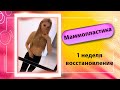 ВОССТАНОВЛЕНИЕ ПОСЛЕ МАММОПЛАСТИКИ || 1 неделя || РАЗНАЯ ГРУДЬ И ОТЕКИ