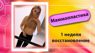 ВОССТАНОВЛЕНИЕ ПОСЛЕ МАММОПЛАСТИКИ || 1 неделя || РАЗНАЯ ГРУДЬ И ОТЕКИ