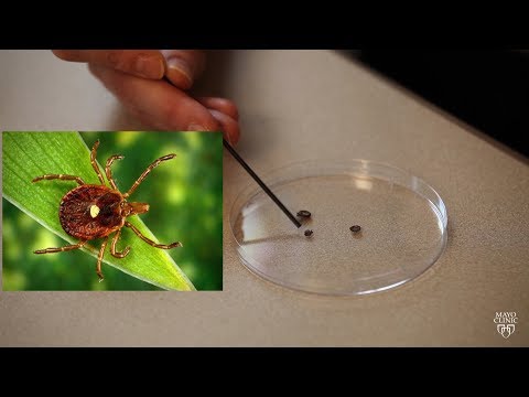 Mayo Clinic Minute: Rise in tick-related meat allergy