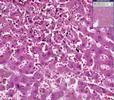 Histopathology Lung and liver--Congestion and hemorrhage