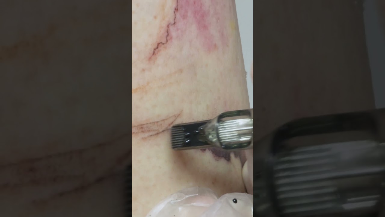 Freehand Chinese Ink Brush Landscape - Tattoo Process by Joey Pang @ JP  Tattoo Art , Hong Kong