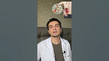 Боль в спине! Как понять где источник боли