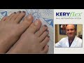 Keryflex nail restoration san diego  jay berenter