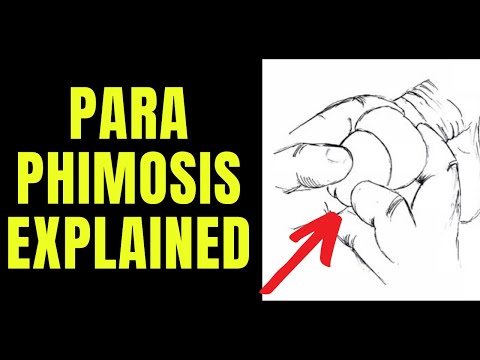 Doctor explains Paraphimosis - aka swollen foreskin that you can&rsquo;t pull back...