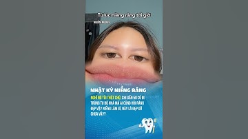 Khó hiểu #nhakhoa #nhatkyniengrang # #viral