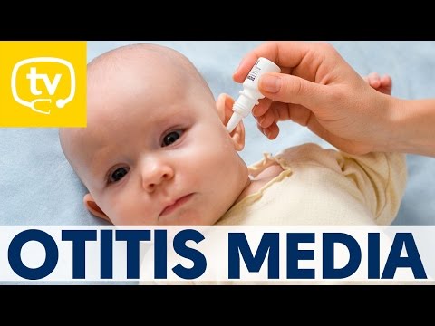Video: Síntomas De Otitis Media En Un Bebé
