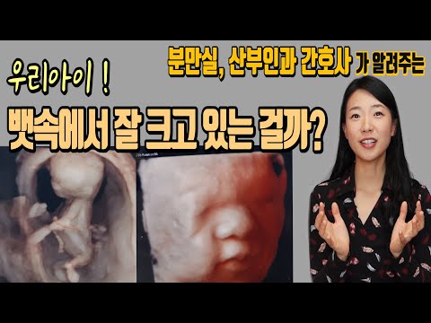 중기이유식시기 추천