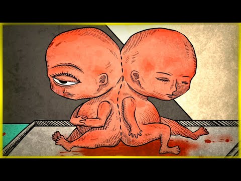 ИСТОРИЯ ОДНОГЛАЗОГО МАЛЬЧИКА ● Life Gallery