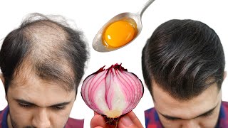 Ik Had Niet Verwacht De Haren Op Mijn Kale Plek Groeien Als Kool 5 Beste Recepten