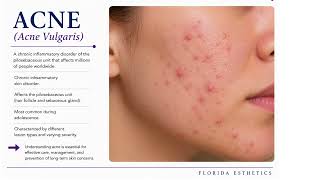 Milady Esthetics Chapter 4 Part 1 - Skin Lesions, Acne, Rosacea & Varicose Veins