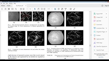 Novel Exudate Inpainting Technique for Retinal Vessel Segmentation