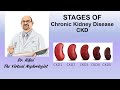 Stages of chronic kidney disease ckd  the virtual nephrologist  dr rifai