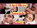 OMG Getting My Nose, Lips and Jaw done!! | (Treatment,Recovery & Result)