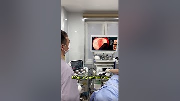 Can thiệp cắt Polyp đại tràng.