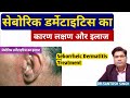 Seborrheic Dermatitis [ Dandruff ] Cause Symptoms and Treatment | सेबोरिक डर्मेटाइटिस कारण और इलाज |